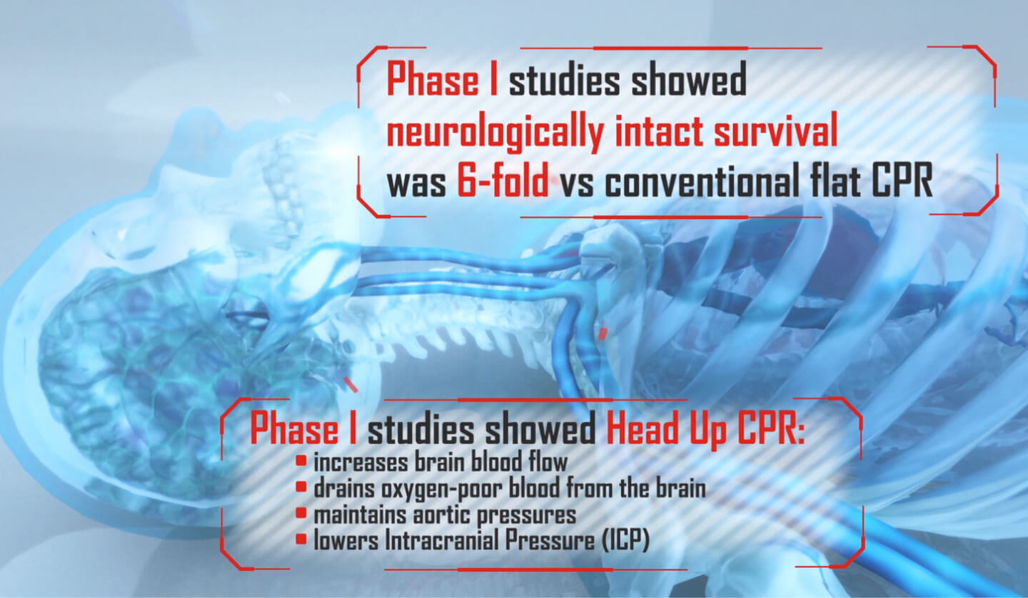 Elevated CPR